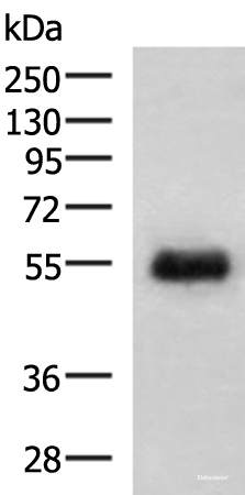 Western blot analysis of Human placenta tissue lysate using GFRA2 Polyclonal Antibody at dilution of 1:400