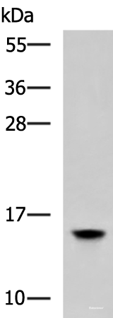 Western blot analysis of Human hepatocellular carcinoma 2 tissue lysate using HMGA2 Polyclonal Antibody at dilution of 1:800