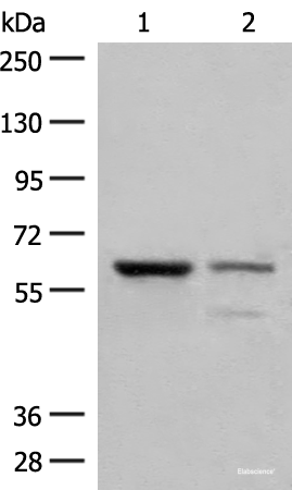 Western blot analysis of Human left kidney cancer tissue and HEPG2 cell lysates using HNF1A Polyclonal Antibody at dilution of 1:200
