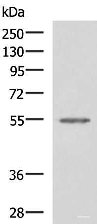 Western blot analysis of Jurkat cell lysate using SLC16A1 Polyclonal Antibody at dilution of 1:550