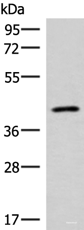 Western blot analysis of Human abdominal interstitial sarcoma tissue lysate using SLC16A7 Polyclonal Antibody at dilution of 1:400