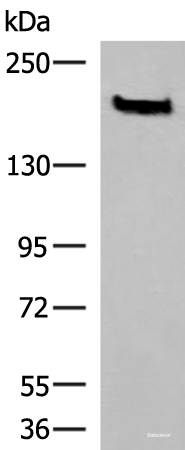 Western blot analysis of Human cerebrum tissue lysate using NCAN Polyclonal Antibody at dilution of 1:650