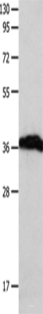 Western blot analysis of Human brain malignant glioma tissue using P2RY6 Polyclonal Antibody at dilution of 1:550