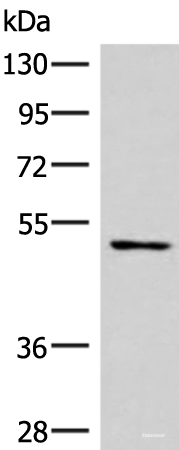 Western blot analysis of Mouse heart tissue lysate using SMAD7 Polyclonal Antibody at dilution of 1:900