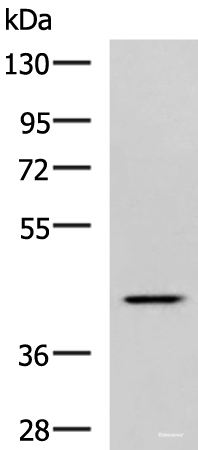 Western blot analysis of Hela cell lysate using SYT2 Polyclonal Antibody at dilution of 1:800
