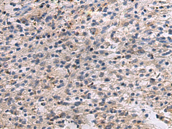 Immunohistochemistry of paraffin-embedded Human brain tissue using ANGPTL2 Polyclonal Antibody at dilution of 1:55(×200)