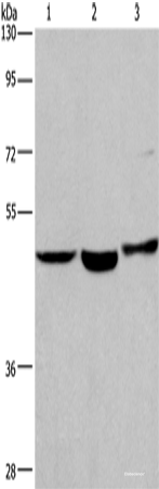 Western blot analysis of Human placenta tissue Human fetal liver tissue 231 cells using APMAP Polyclonal Antibody at dilution of 1:400