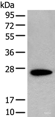 Western blot analysis of NIH/3T3 cell lysate using CD63 Polyclonal Antibody at dilution of 1:250