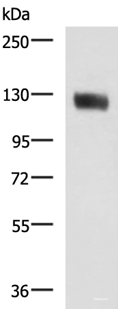 Western blot analysis of Human leiomyosarcoma tissue lysate using MCAM Polyclonal Antibody at dilution of 1:400