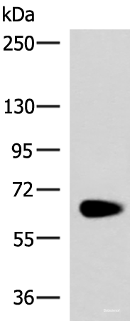 Western blot analysis of Human left kidney paracancerous tissue lysate using NOTCH4 Polyclonal Antibody at dilution of 1:800