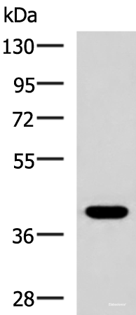 Western blot analysis of HepG2 cell lysate using PLPPR5 Polyclonal Antibody at dilution of 1:1500