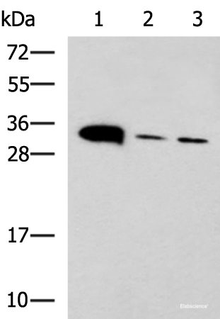 Western blot analysis of Mouse heart tissue Mouse stomach tissue and PC-3 cell lysates using PSCA Polyclonal Antibody at dilution of 1:650