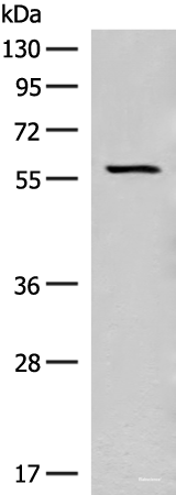 Western blot analysis of Mouse eye tissue lysate using SLC5A1 Polyclonal Antibody at dilution of 1:350