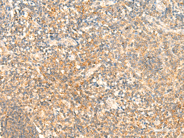 Immunohistochemistry of paraffin-embedded Human tonsil tissue using CD93 Polyclonal Antibody at dilution of 1:50(×200)