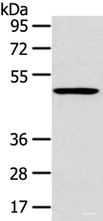 Western blot analysis of 231 cell using HTRA1 Polyclonal Antibody at dilution of 1:500
