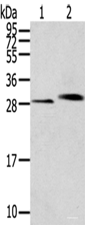 Western blot analysis of Human normal kidney tissue Human liver tissue using CLIC4 Polyclonal Antibody at dilution of 1:200
