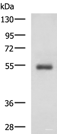 Western blot analysis of Human 2-3 grade invasive ductal breast tissue lysate using RHCG Polyclonal Antibody at dilution of 1:600