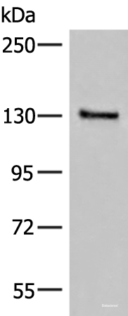 Western blot analysis of Human urinary bladder tissue lysate using SASH1 Polyclonal Antibody at dilution of 1:300
