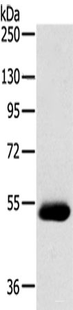 Western blot analysis of Human breast infiltrative duct tissue using SERINC4 Polyclonal Antibody at dilution of 1:200