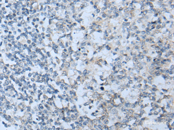 Immunohistochemistry of paraffin-embedded Human tonsil tissue using STARD4 Polyclonal Antibody at dilution of 1:50(×200)