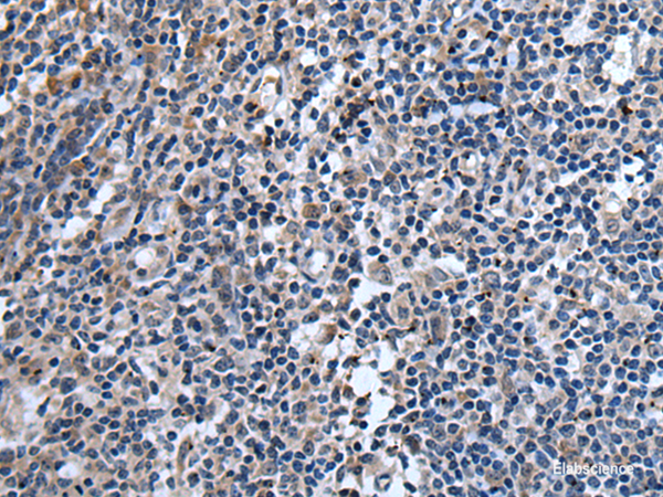 Immunohistochemistry of paraffin-embedded Human tonsil tissue using TNFSF18 Polyclonal Antibody at dilution of 1:45(×200)
