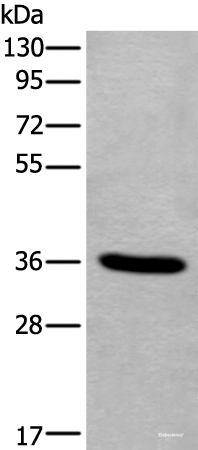 Western blot analysis of Human fetal liver tissue lysate using TNMD Polyclonal Antibody at dilution of 1:400