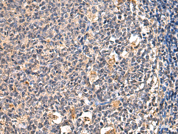 Immunohistochemistry of paraffin-embedded Human tonsil tissue using ENTPD1 Polyclonal Antibody at dilution of 1:60(×200)