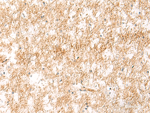 Immunohistochemistry of paraffin-embedded Human brain tissue using XPC Polyclonal Antibody at dilution of 1:25(×200)