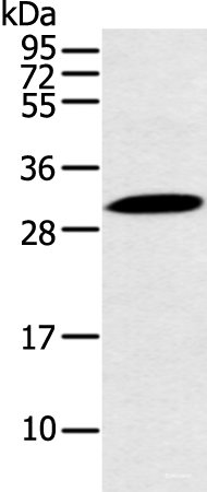 Western blot analysis of Mouse stomach tissue using YRDC Polyclonal Antibody at dilution of 1:250