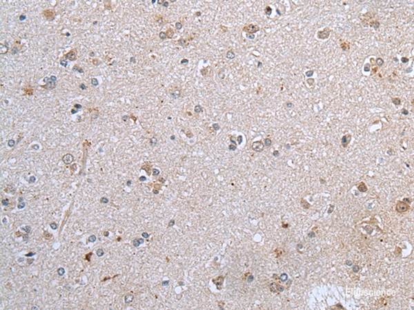 Immunohistochemistry of paraffin-embedded Human brain tissue using CLDN12 Polyclonal Antibody at dilution of 1:45(×200)