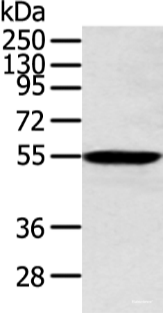 Western blot analysis of Human lung cancer tissue using ALDH2 Polyclonal Antibody at dilution of 1:300