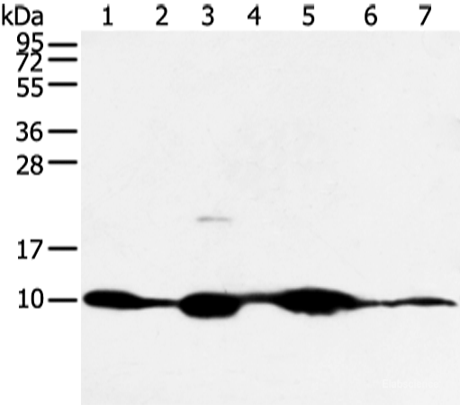Western blot analysis of Mouse muscle and human fetal muscle tissue mouse heart tissue and PC3 cell mouse kidney and small intestines tissue 231 cell using COX7C Polyclonal Antibody at dilution of 1:300