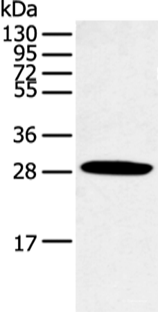 Western blot analysis of Human normal lung tissue using CLDN25 Polyclonal Antibody at dilution of 1:250