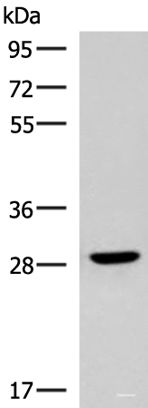 Western blot analysis of Human fetal brain tissue lysate using CLEC9A Polyclonal Antibody at dilution of 1:800