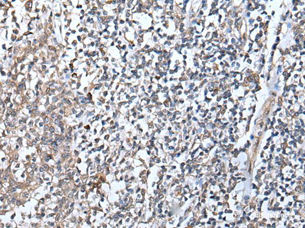 Immunohistochemistry of paraffin-embedded Human tonsil tissue using DEFB104A Polyclonal Antibody at dilution of 1:50(×200)
