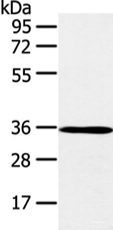Western blot analysis of K562 cell and mouse brain tissue using E2F5 Polyclonal Antibody at dilution of 1:400