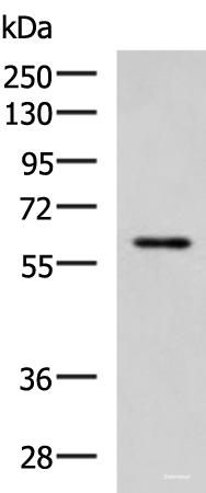 Western blot analysis of MCF7 cell lysate using ECM1 Polyclonal Antibody at dilution of 1:1000