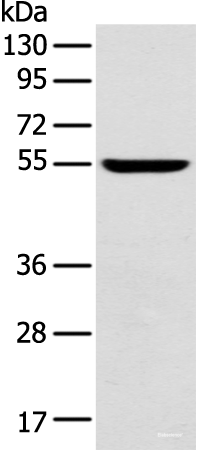 Western blot analysis of Mouse brain tissue using FOXG1 Polyclonal Antibody at dilution of 1:550