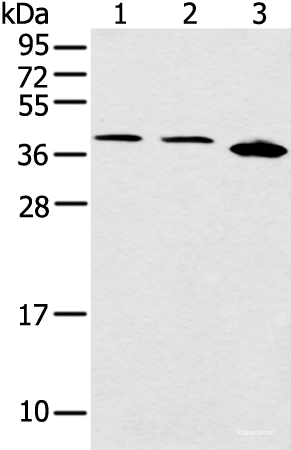 Western blot analysis of Jurkat Hela and 231 cell using CCNG1 Polyclonal Antibody at dilution of 1:400