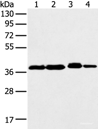 Western blot analysis of 293T K562 Jurkat cell using DCX Polyclonal Antibody at dilution of 1:500