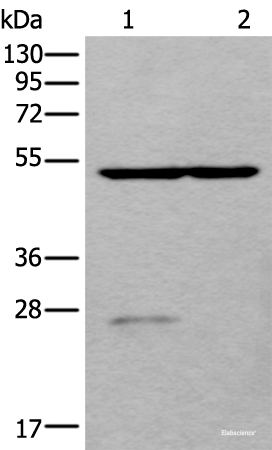 Western blot analysis of Human left kidney tissue and Human fetal liver tissue lysates using DDC Polyclonal Antibody at dilution of 1:800