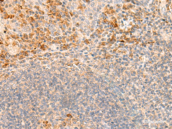 Immunohistochemistry of paraffin-embedded Human tonsil tissue using GRM2 Polyclonal Antibody at dilution of 1:35(×200)