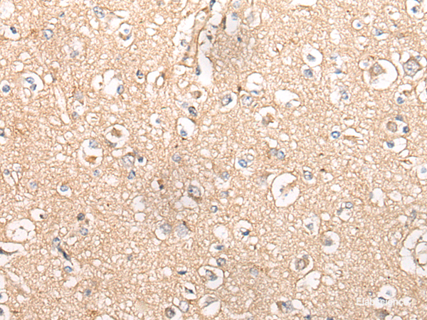 Immunohistochemistry of paraffin-embedded Human brain tissue using MTNR1B Polyclonal Antibody at dilution of 1:55(×200)