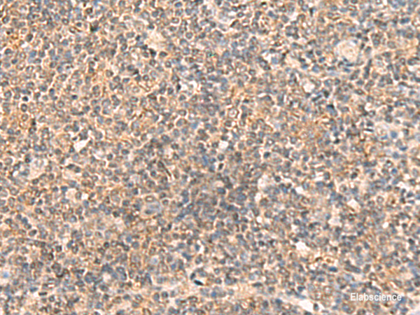 Immunohistochemistry of paraffin-embedded Human tonsil tissue using ABCB4 Polyclonal Antibody at dilution of 1:40(×200)