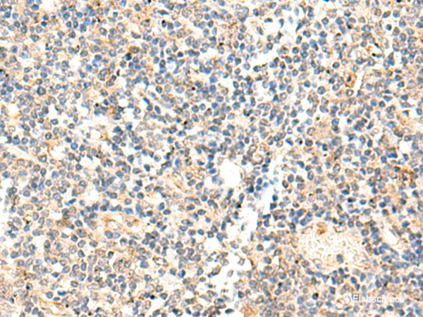 Immunohistochemistry of paraffin-embedded Human tonsil tissue using ADAMTS2 Polyclonal Antibody at dilution of 1:40(×200)