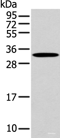 Western blot analysis of Mouse muscle tissue using NANOS1 Polyclonal Antibody at dilution of 1:500