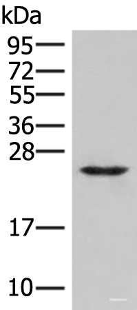 Western blot analysis of Human fetal brain tissue lysate using MRAS Polyclonal Antibody at dilution of 1:400
