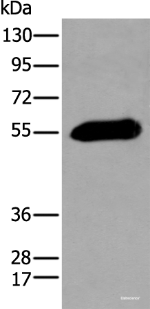 Western blot analysis of Human pancreas tissue using GPC4 Polyclonal Antibody at dilution of 1:200