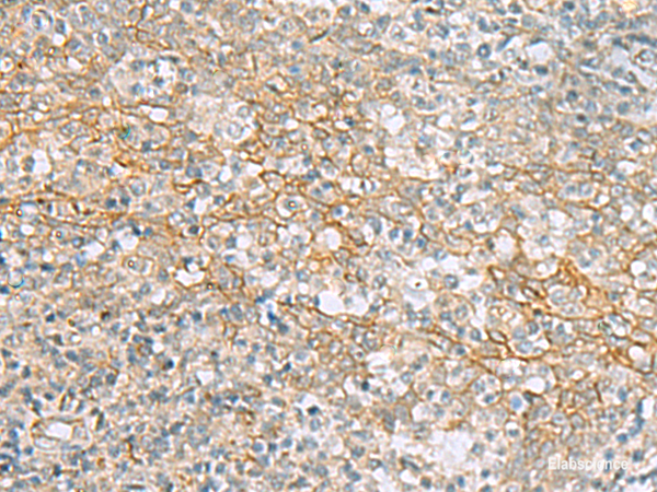 Immunohistochemistry of paraffin-embedded Human tonsil tissue using KCNH7 Polyclonal Antibody at dilution of 1:60(×200)