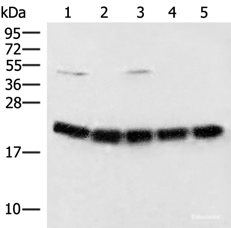 Western blot analysis of Raji cell Mouse brain tissue Hela A375 and 231 cell lysates using ARF5 Polyclonal Antibody at dilution of 1:400